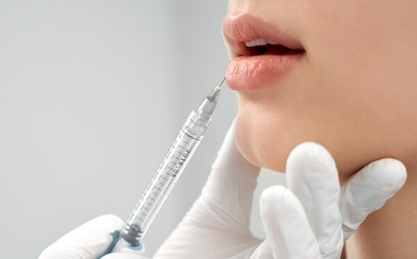 Aumento de Labios - Imagen 2